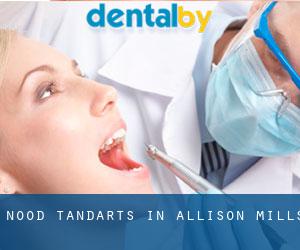 Nood tandarts in Allison Mills