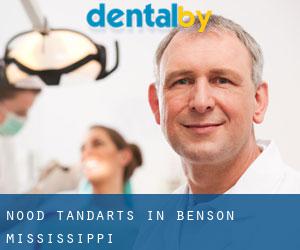 Nood tandarts in Benson (Mississippi)