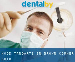 Nood tandarts in Brown Corner (Ohio)