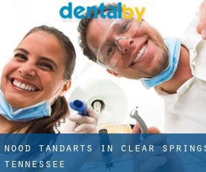 Nood tandarts in Clear Springs (Tennessee)