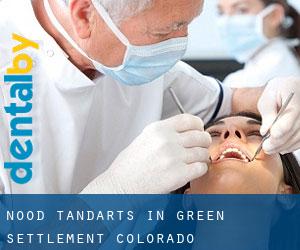 Nood tandarts in Green Settlement (Colorado)
