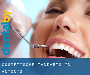 Cosmetische tandarts in Antonis
