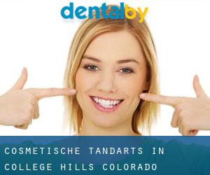 Cosmetische tandarts in College Hills (Colorado)