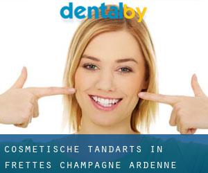 Cosmetische tandarts in Frettes (Champagne-Ardenne)