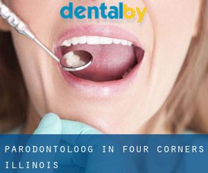 Parodontoloog in Four Corners (Illinois)