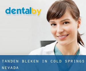 Tanden bleken in Cold Springs (Nevada)