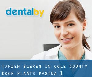 Tanden bleken in Cole County door plaats - pagina 1
