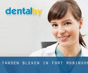 Tanden bleken in Fort Robinson