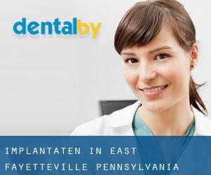Implantaten in East Fayetteville (Pennsylvania)