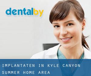 Implantaten in Kyle Canyon Summer Home Area