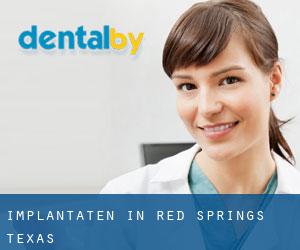Implantaten in Red Springs (Texas)