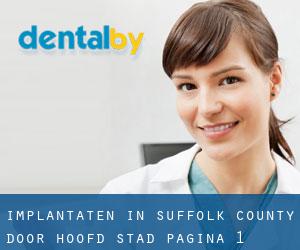 Implantaten in Suffolk County door hoofd stad - pagina 1