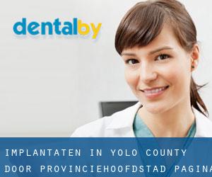 Implantaten in Yolo County door provinciehoofdstad - pagina 1