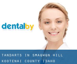 tandarts in Smaq'wqn Hill (Kootenai County, Idaho)