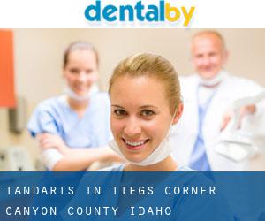 tandarts in Tiegs Corner (Canyon County, Idaho)