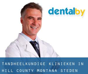 tandheelkundige klinieken in Hill County Montana (Steden) - pagina 1