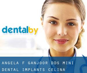 Angela F. Ganjoor, DDS Mini Dental Implants (Celina)