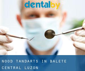 Nood tandarts in Balete (Central Luzon)
