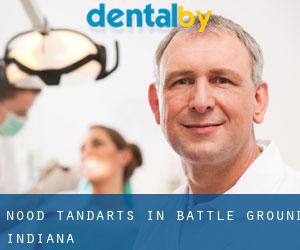 Nood tandarts in Battle Ground (Indiana)