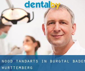 Nood tandarts in Burgtal (Baden-Württemberg)
