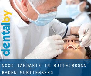 Nood tandarts in Büttelbronn (Baden-Württemberg)