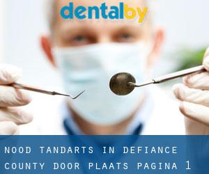 Nood tandarts in Defiance County door plaats - pagina 1
