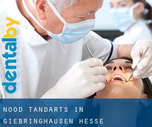 Nood tandarts in Giebringhausen (Hesse)