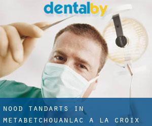 Nood tandarts in Metabetchouan–Lac-a-la-Croix