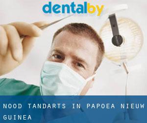 Nood tandarts in Papoea-Nieuw-Guinea