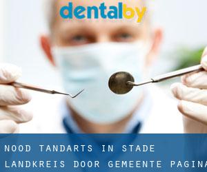 Nood tandarts in Stade Landkreis door gemeente - pagina 1