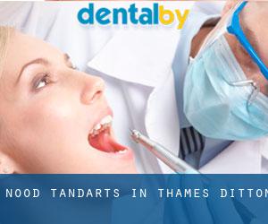 Nood tandarts in Thames Ditton