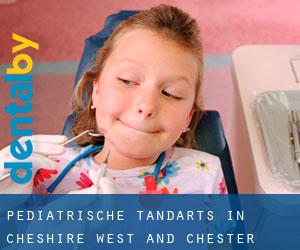 Pediatrische tandarts in Cheshire West and Chester