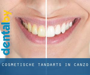 Cosmetische tandarts in Canzo