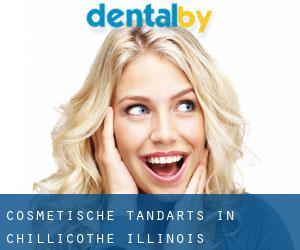 Cosmetische tandarts in Chillicothe (Illinois)