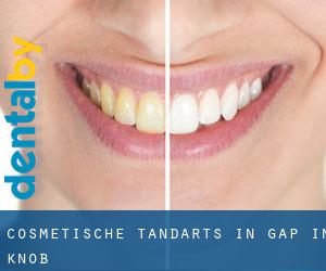Cosmetische tandarts in Gap in Knob