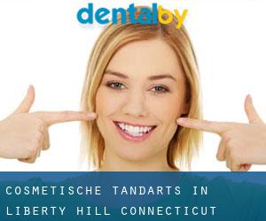 Cosmetische tandarts in Liberty Hill (Connecticut)
