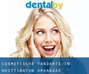 Cosmetische tandarts in Whittington (Arkansas)