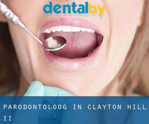 Parodontoloog in Clayton Hill II