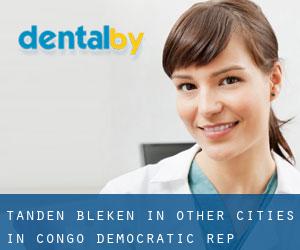 Tanden bleken in Other Cities in Congo, Democratic Rep.