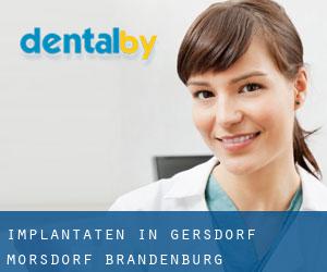 Implantaten in Gersdorf-Mörsdorf (Brandenburg)