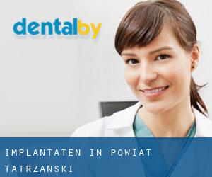 Implantaten in Powiat tatrzański