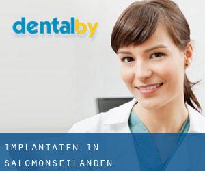 Implantaten in Salomonseilanden Implantaten in Salomonseilanden