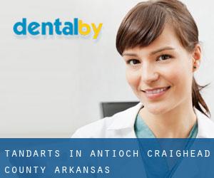tandarts in Antioch (Craighead County, Arkansas)