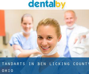 tandarts in Ben (Licking County, Ohio)